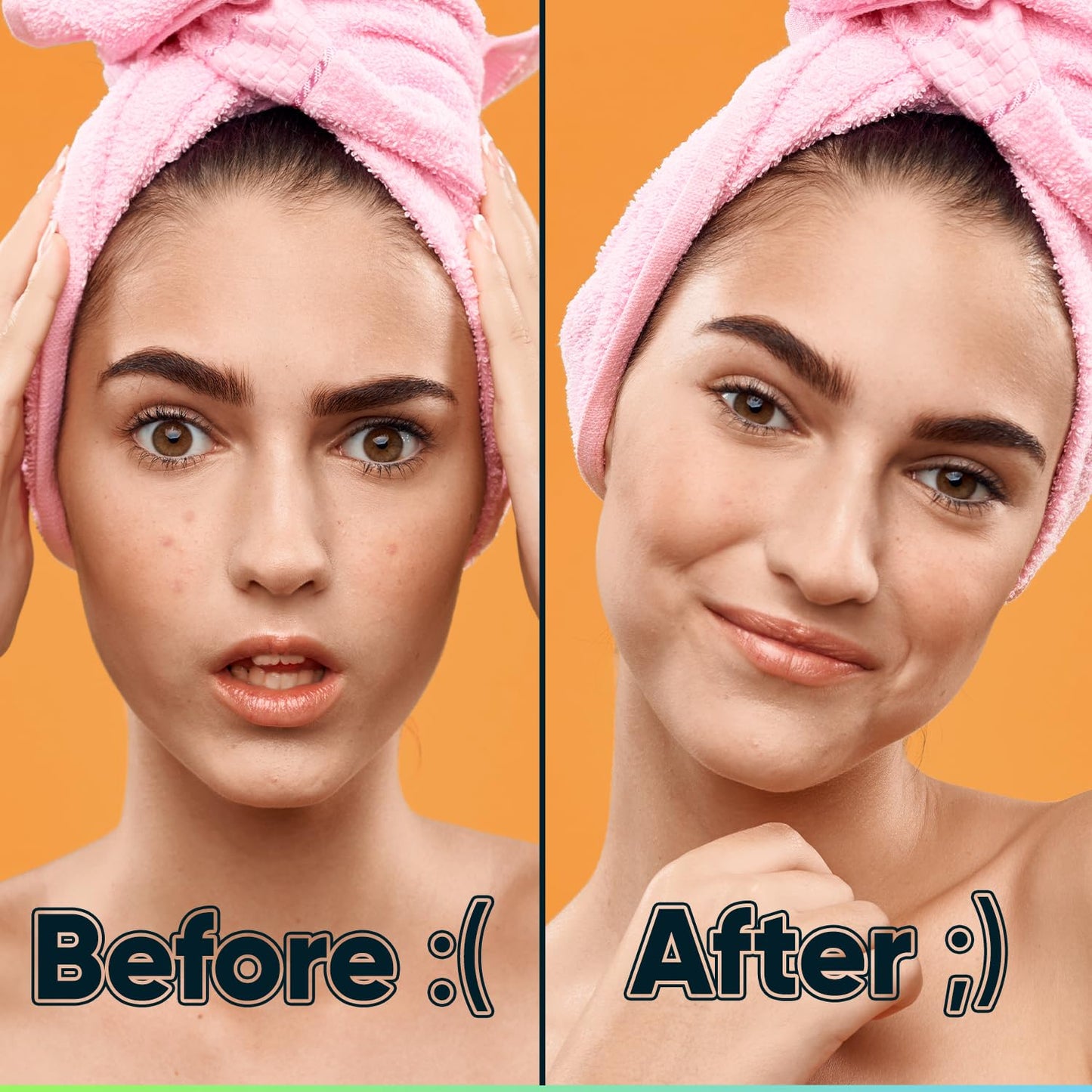 BIORICA Acne Pimple Patches